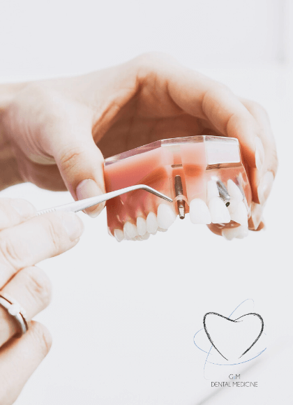 Tratamiento-implante-dental